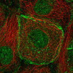 BMPR2 Polyclonal Antibody