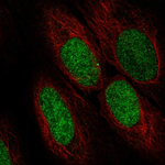 ASF1A Polyclonal Antibody