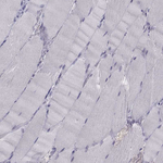 PAX2 Antibody in Immunohistochemistry (Paraffin) (IHC (P))