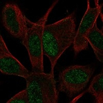 ASCL1 Polyclonal Antibody