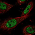 ERCC1 Polyclonal Antibody
