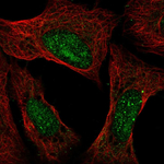 Ataxin 3 Antibody in Immunocytochemistry (ICC/IF)