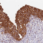 TIGAR Antibody in Immunohistochemistry (Paraffin) (IHC (P))