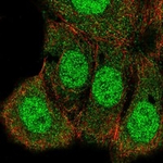 H-Ras Polyclonal Antibody