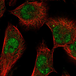 SGK1 Polyclonal Antibody
