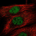 TBK1 Antibody in Immunocytochemistry (ICC/IF)