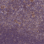 TBK1 Antibody in Immunohistochemistry (Paraffin) (IHC (P))