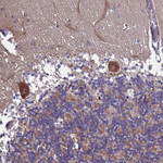 TBK1 Antibody in Immunohistochemistry (Paraffin) (IHC (P))