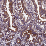 TBK1 Antibody in Immunohistochemistry (Paraffin) (IHC (P))