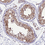 TBK1 Antibody in Immunohistochemistry (Paraffin) (IHC (P))
