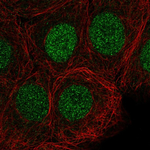 SIRT6 Antibody in Immunocytochemistry (ICC/IF)