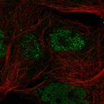 cGAS Polyclonal Antibody