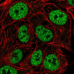 TBK1 Polyclonal Antibody