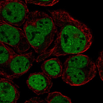 CX3CR1 Antibody in Immunocytochemistry (ICC/IF)