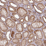 Caspase 2 Antibody in Immunohistochemistry (Paraffin) (IHC (P))
