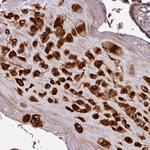Caspase 2 Antibody in Immunohistochemistry (Paraffin) (IHC (P))
