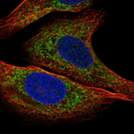 IGFBP2 Antibody in Immunocytochemistry (ICC/IF)
