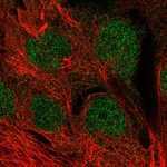 MGMT Polyclonal Antibody