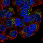 GDF15 Polyclonal Antibody