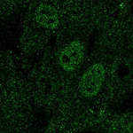 TAL1 Polyclonal Antibody