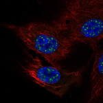 NFATC4 Antibody in Immunocytochemistry (ICC/IF)