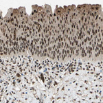 PML Polyclonal Antibody