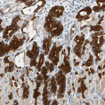 TAK1 Antibody in Immunohistochemistry (Paraffin) (IHC (P))