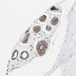 TAK1 Antibody in Immunohistochemistry (Paraffin) (IHC (P))