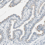 TAK1 Antibody in Immunohistochemistry (Paraffin) (IHC (P))