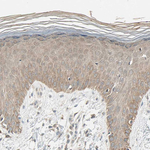 TAK1 Antibody in Immunohistochemistry (Paraffin) (IHC (P))