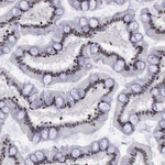 YY1 Antibody in Immunohistochemistry (Paraffin) (IHC (P))