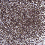 YY1 Antibody in Immunohistochemistry (Paraffin) (IHC (P))