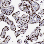 YY1 Antibody in Immunohistochemistry (Paraffin) (IHC (P))