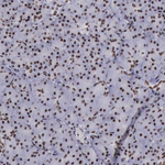 YY1 Antibody in Immunohistochemistry (Paraffin) (IHC (P))