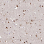 HDAC3 Antibody in Immunohistochemistry (Paraffin) (IHC (P))