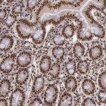 SP1 Antibody in Immunohistochemistry (Paraffin) (IHC (P))