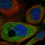 STAT5 alpha Polyclonal Antibody