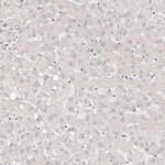 STAT5 alpha Antibody in Immunohistochemistry (Paraffin) (IHC (P))