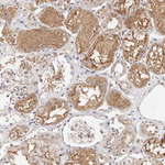 STAT5 alpha Antibody in Immunohistochemistry (Paraffin) (IHC (P))