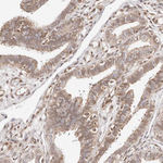 STAT5 alpha Antibody in Immunohistochemistry (Paraffin) (IHC (P))