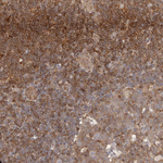STAT5 alpha Antibody in Immunohistochemistry (Paraffin) (IHC (P))