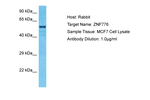 ZNF776 Polyclonal Antibody