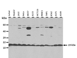 ZNF580 Polyclonal Antibody