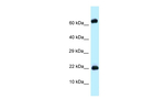 ZNF580 Antibody in Western Blot (WB)