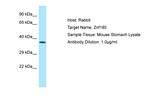 ZNF185 Polyclonal Antibody