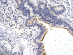 ZNF180 Polyclonal Antibody