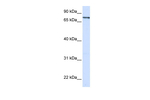 ZNF180 Antibody in Western Blot (WB)