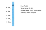 ZNF160 Polyclonal Antibody