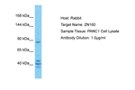 ZNF160 Antibody in Western Blot (WB)