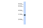 ZMYND19 Antibody in Western Blot (WB)